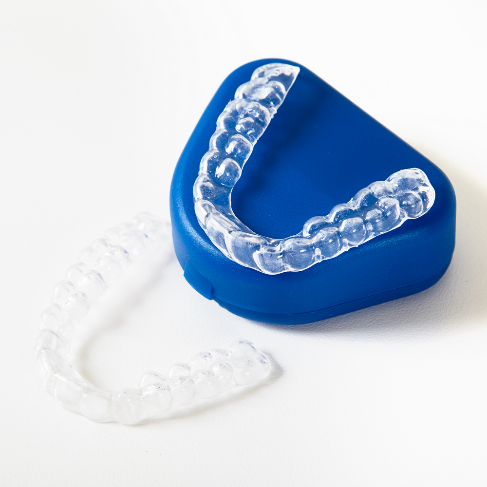 台中矯正-隱形矯正懶人包｜Invisalign 與傳統矯正完整比較