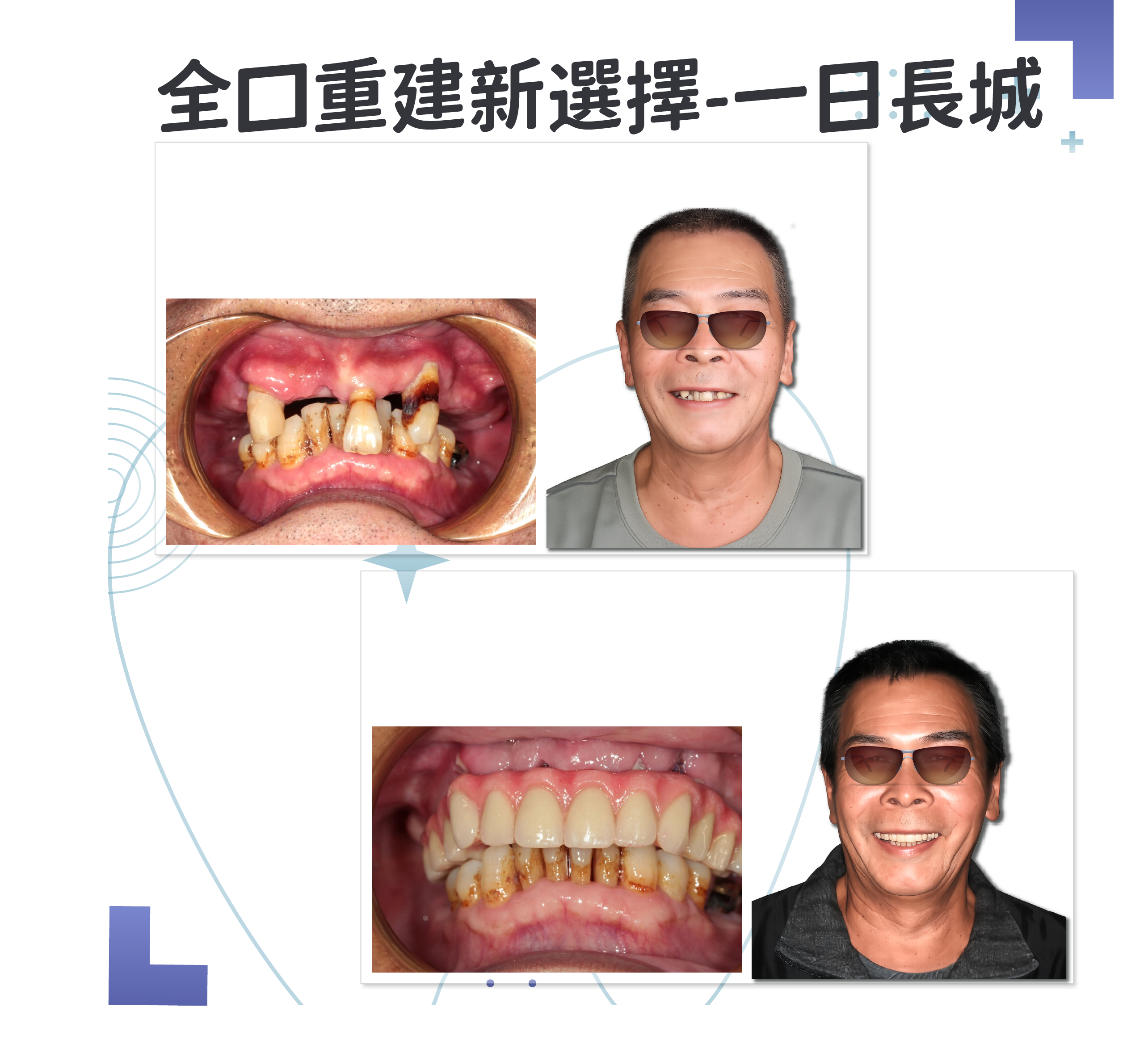 一日長城案例-台中粹齒以先